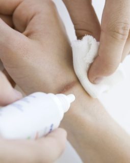 TRATAMIENTO DE CICATRICES Y HERIDAS